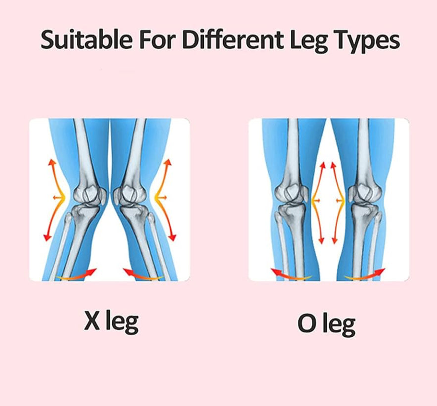 Leg Correction Brace, Inflatable Leg Posture Corrector Belt Band, Adjustable Legs Straightening Belt, Knock Knees Valgus Deformity Bow Legs Band for Straighten Bow Splay Legs